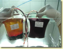 Bolsas para Extracci&oacute;n de Suero Fetal